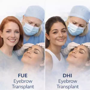 DHI Eyebrow Transplant