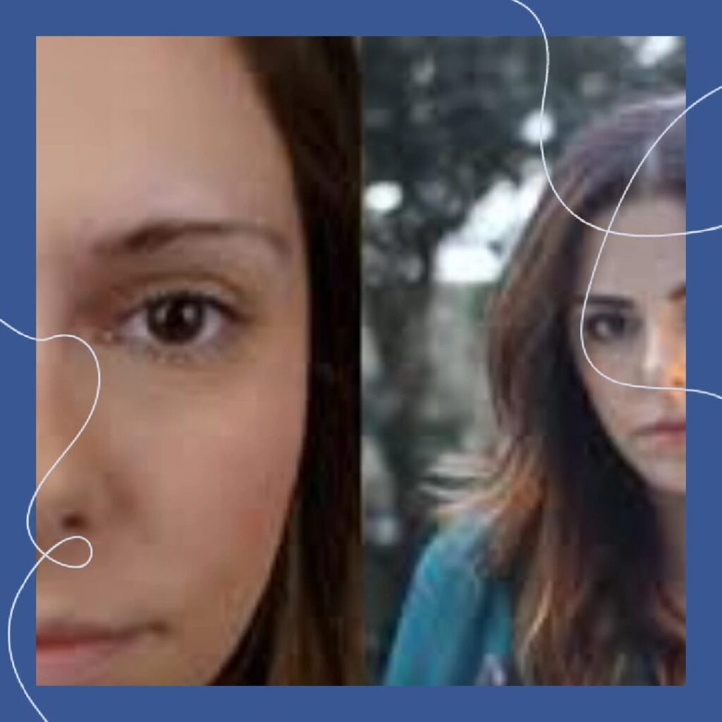 Eyebrow Transplant in Antalya