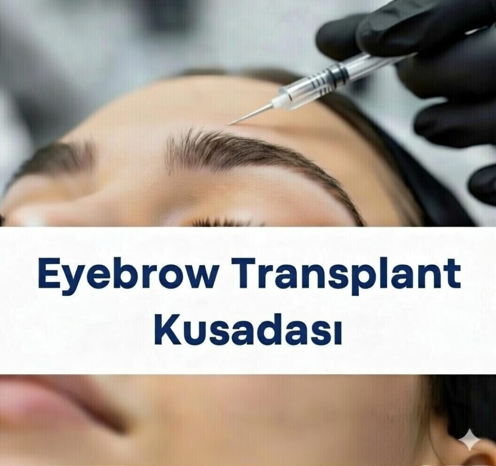 Eyebrow Transplant in Kuşadası