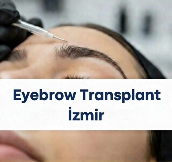 Eyebrow Transplant in İzmir