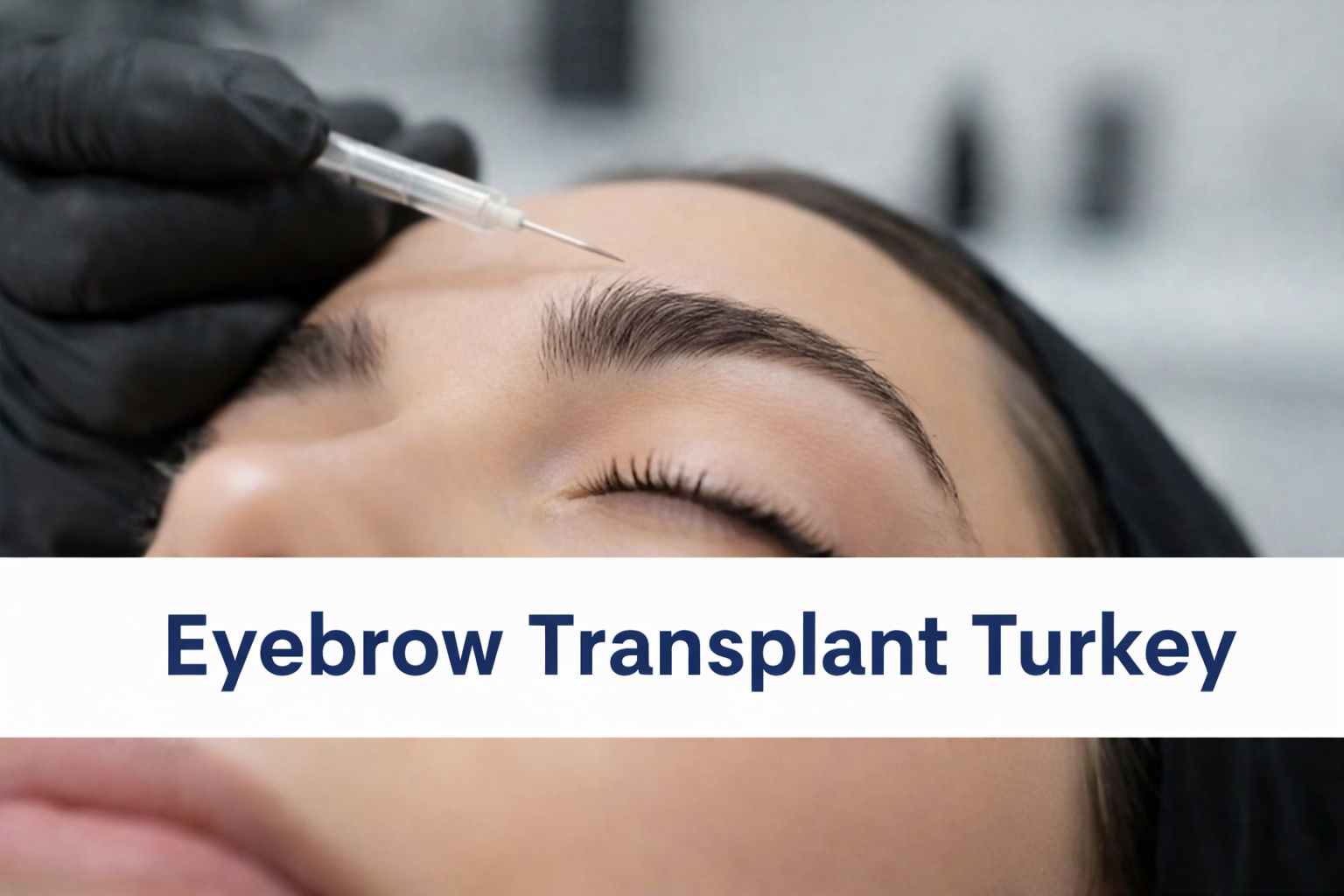 Eyebrow Transplant Turkey natural fuller brows women FUE procedure